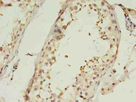 C1QTNF6 / CTRP6 Antibody