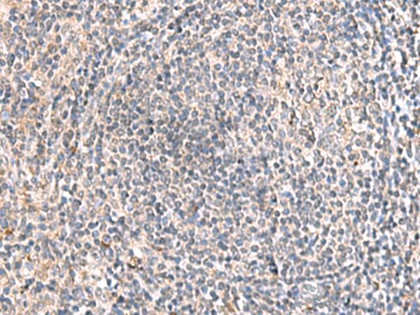 HLA-DOB Antibody