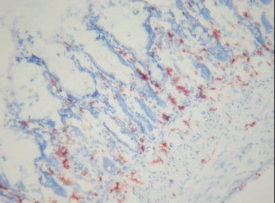 Macrophage Antibody (clone AnP95)