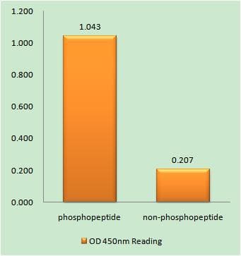 TGFBR2 Antibody (phospho-Ser225/250)