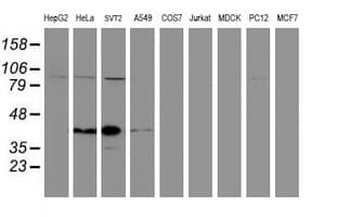 Paraplegin / SPG7 Antibody (clone OTI1C12)