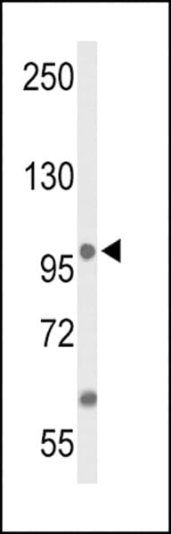 ANO7 / TMEM16G / NGEP Antibody (aa106-135)
