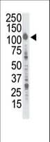 INSRR Antibody (aa1256-1287)