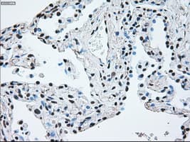 BRAF / B-Raf Antibody (clone OTI4C11)