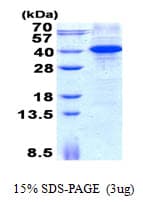 Human MYD88 Protein (Recombinant His)