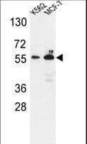 G6PD Antibody (aa297-326)
