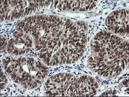 LMO2 Antibody (clone OTI1G10)