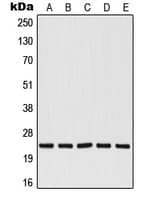 RALB Antibody (Internal)