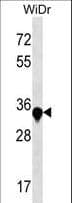Polyclonal Rabbit anti-Human AMMECR1 Antibody (aa271-298, WB)