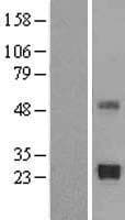 TIMP2 Protein (Over-Expression Lysate Myc-DDK (Flag))