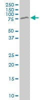 MECP2 Antibody (clone 1B11)