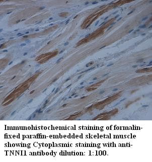 TNNI1 Antibody (N-Terminus)