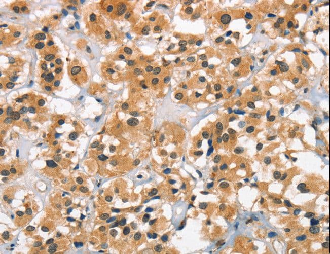 Polyclonal Rabbit anti-Human CACNA1C / Cav1.2 Antibody (IHC)