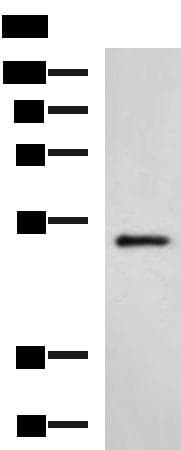 HTRA2 / OMI Antibody