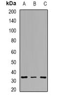 TPM2 Antibody
