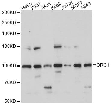 Polyclonal Rabbit anti-Human ORC1 Antibody (WB)