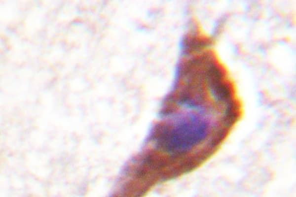 GRIN1 / NMDAR1 Antibody (Ser885)