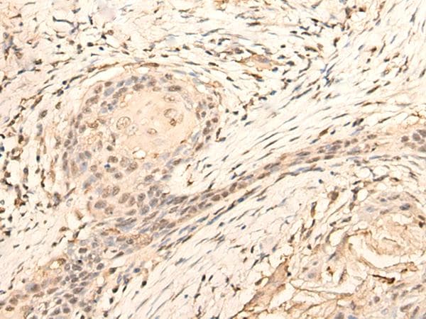 DAZ1 / DAZ Antibody