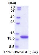 Human SYNJ2BP / OMP25 Protein (Recombinant His)