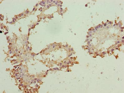 ZNF184 Antibody