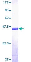 Human COL20A1 / Collagen XX Protein (Recombinant GST)