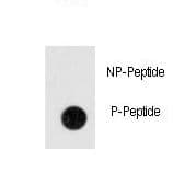 ANTXR1 / TEM8 Antibody (phospho-Tyr382)