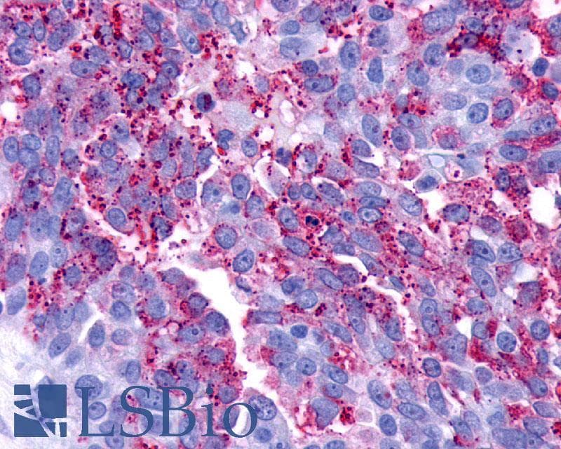 PathPlus™ Polyclonal Rabbit anti-Human LPAR3 / LPA3 / EDG7 Antibody (Cytoplasmic Domain, IHC)