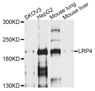 IHC-plus™ LRP4 Antibody
