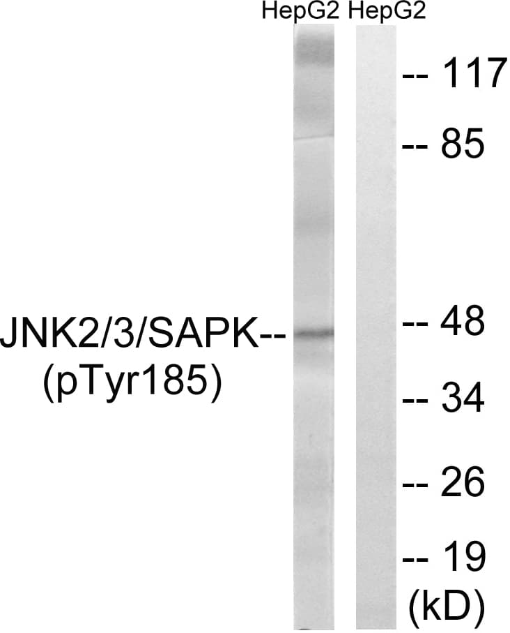 Polyclonal Rabbit anti-Human SAPK / JNK / MAPK8 + MAPK9 + MAPK10 Antibody (phospho-Tyr185, IHC, WB)