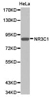 NR3C1/Glucocorticoid Receptor Antibody