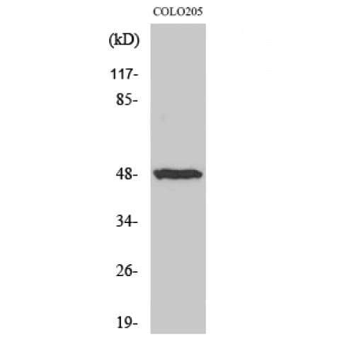 IL13RA1 / IL13R Alpha 1 Antibody (340-420 aa)