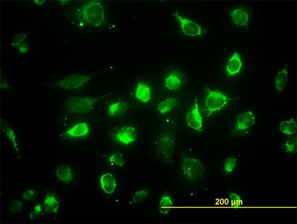 IHC-plus™ ACAA2 Antibody (clone 5C4)