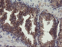 UBE2J1 Antibody (clone OTI1F6)