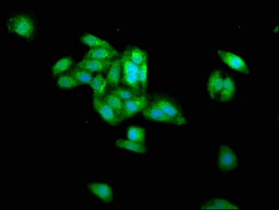 PRAME Antibody (aa1-509)