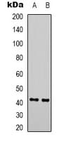 GALR2 / Galanin Receptor 2 Antibody