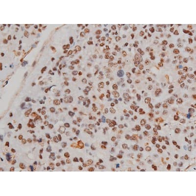 Polyclonal Rabbit anti-Human FLNA / Filamin A Antibody (phospho-Ser2152, IHC, IF, WB)
