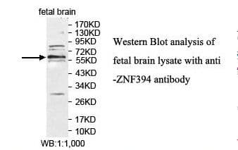 ZNF394 Antibody (aa163-345)