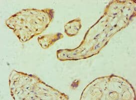 DFNA5 Antibody (aa1-260)