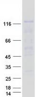 Human NRP2 / Neuropilin 2 Protein (Recombinant Myc-DDK (Flag))