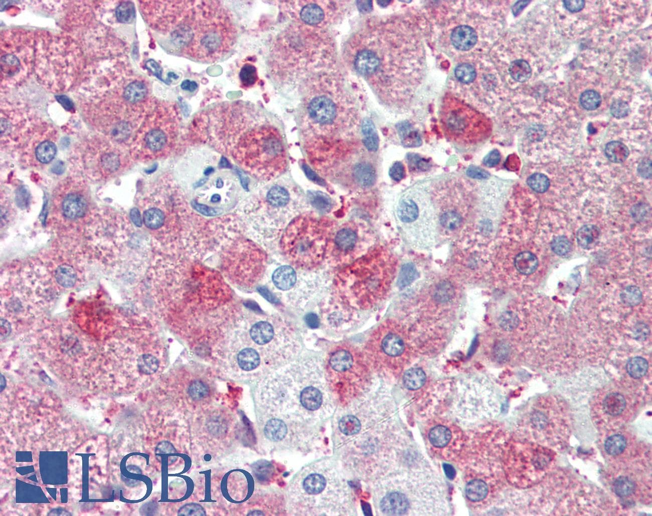 IHC-plus™ Polyclonal Goat anti-Human BAP / SIL1 Antibody (aa448-461, IHC, WB)