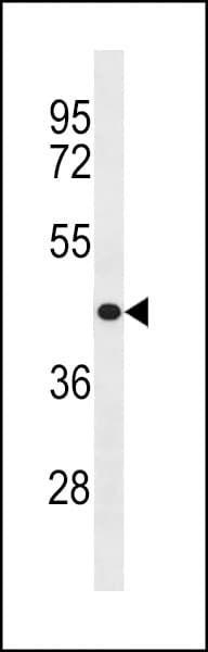 Polyclonal Rabbit anti-Human ZNF73 Antibody (aa1-30, WB)