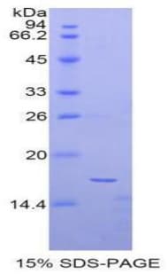 Human Alpha-Fetoprotein (Recombinant His)