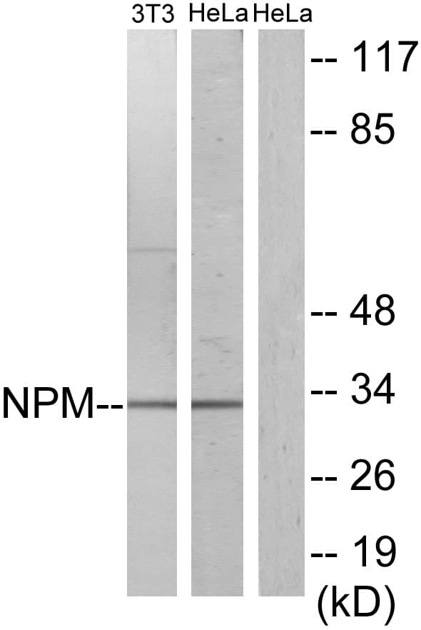 IHC-plus™ Polyclonal Rabbit anti-Human NPM1 / NPM / Nucleophosmin Antibody (aa201-250, IHC, IF, WB)