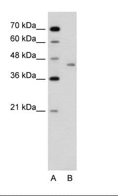LRP2BP / LRP2 Binding Protein Antibody (aa151-200, FITC)