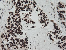 ZSCAN18 / ZNF447 Antibody (clone OTI2H7, Carrier-free)
