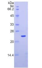 Mouse ITGAM / CD11b Protein (Recombinant His)