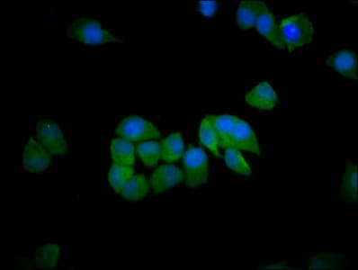 SH3RF1 / POSH Antibody
