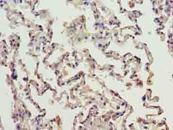 Polyclonal Rabbit anti-Human ERCC6L2 Antibody (IHC)
