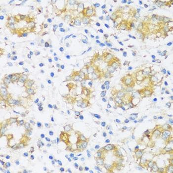 Polyclonal Rabbit anti-Human KIAA1811 / BRSK1 Antibody (IHC)