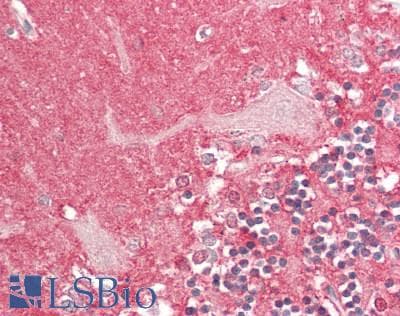 IHC-plus™ ADCYAP1R1 / PAC1 Receptor Antibody (aa21-120)